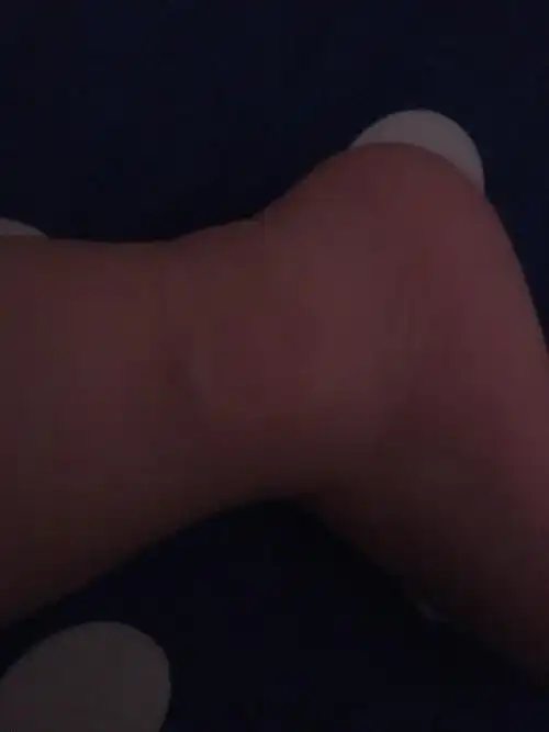 脚背上青筋突出是怎么回事 脚背上青筋突出是怎么回事儿