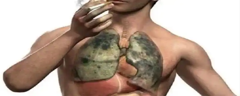 肺与肝是不同的,肝的再造能力非常强,而肺的损害例如肺结核灶,钙化,肺