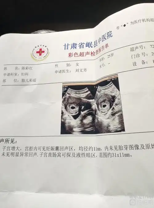 可以!孕囊形状看性别准不准"愿得一心人"-第1张图片-美宝网