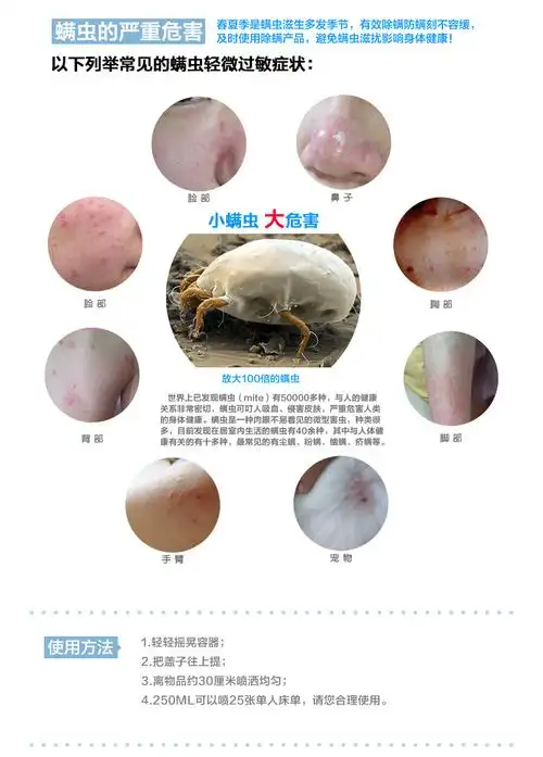 日本uyeki强效去螨虫喷剂 除螨杀螨虫喷雾剂 除螨虫床上用品