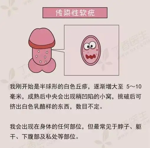 男性丁丁上面长了疙瘩究竟是怎么回事会不会是性病感染