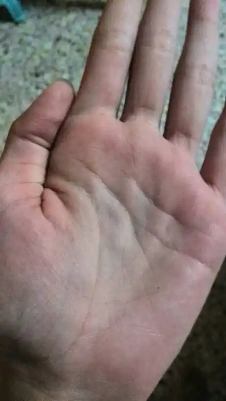 智慧线中间断开,是什么意思?会看手相的大神来,谢谢了!