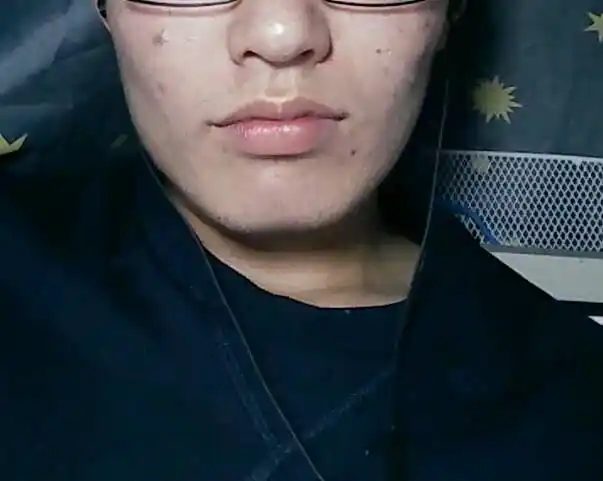 可能是由于单侧咀嚼的问题出现了大小脸的症状而且嘴巴也有点歪,如图.