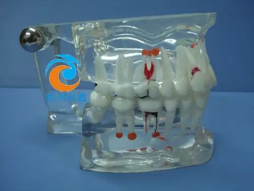 综合病理水晶牙列模型(28颗牙) bz-km053a