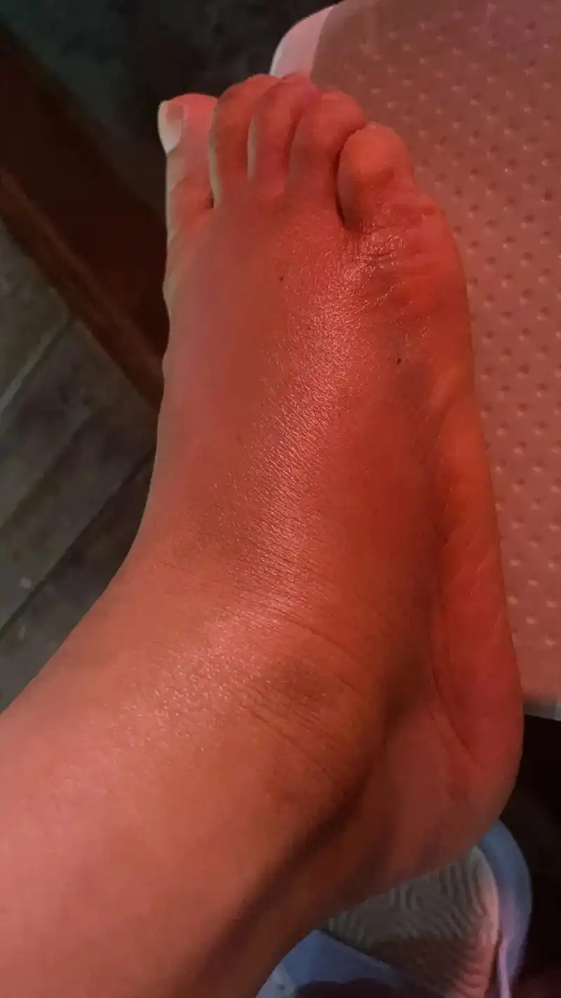 不小心摔了一跤,虽然很疼,但是我没有怪路不平,怪我自己眼睛17 - 抖