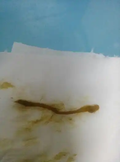大便里有扁扁的细长条的东西,不动,好像还有一个头