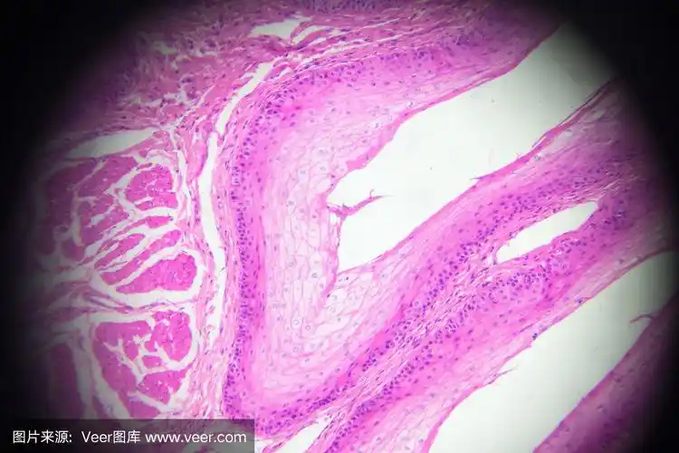 显微镜下呈层状鳞状上皮