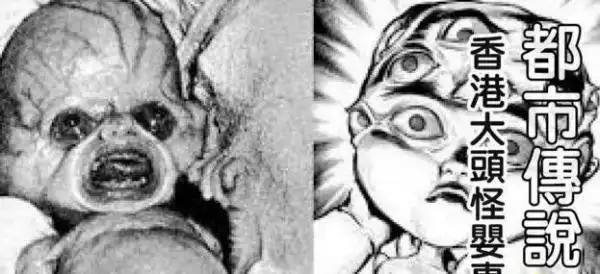 香港大头怪婴真实事件恐怖婴儿头上全是眼睛图片