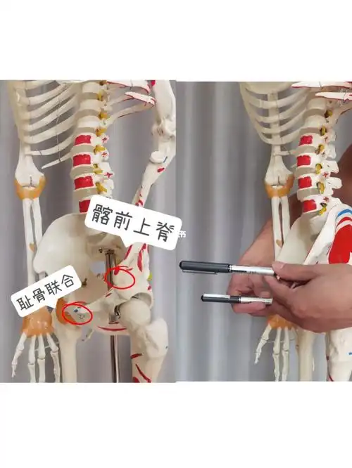 这里用图文给大家详细介绍,第一步,确定耻骨联合与髂前上棘的位置