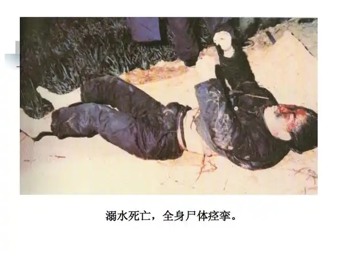 溺水死亡,全身尸体痉挛.