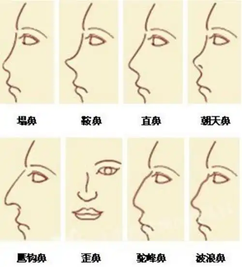 干货分享 美鼻手术必看攻略 壹 鼻部构造