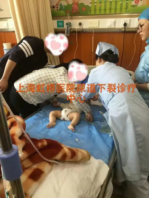 尿道下裂是男性常见先天性畸形,手术治疗方式较复杂