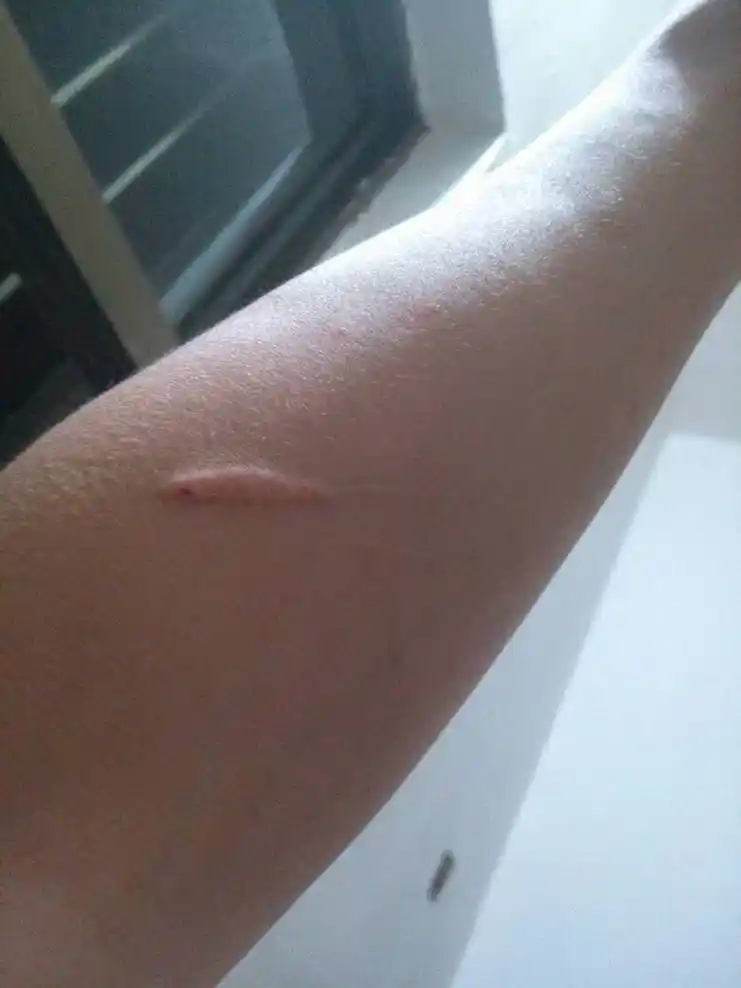 有这伤疤能行么?