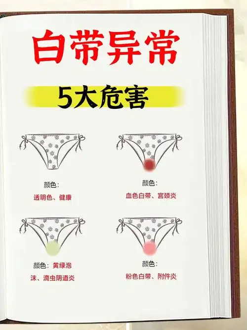 白带异常的5大危害你不会还不知道吧