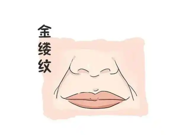 嘴角两边有竖纹面相 嘴角两边长了一道竖纹-卜安居