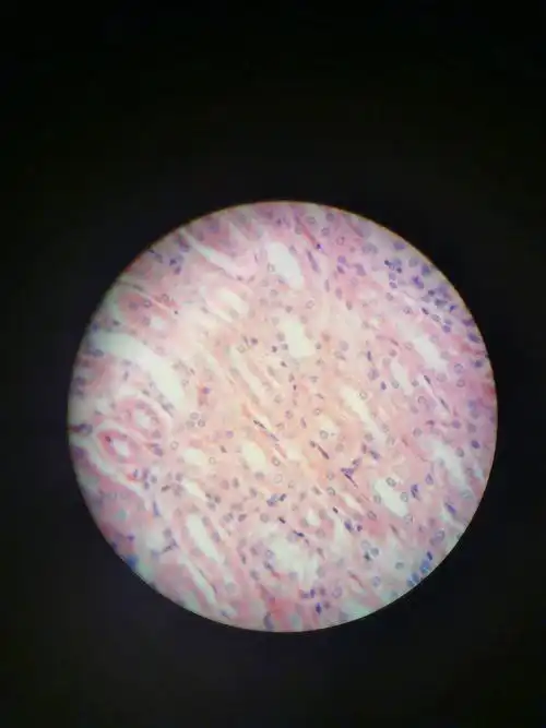 其它 切片 写美篇心肌(示闰盘) 中动脉中静脉