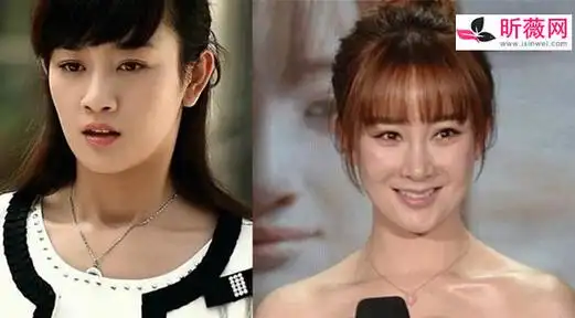 张檬最后悔的事情是整容张檬整容原因及前后对比照