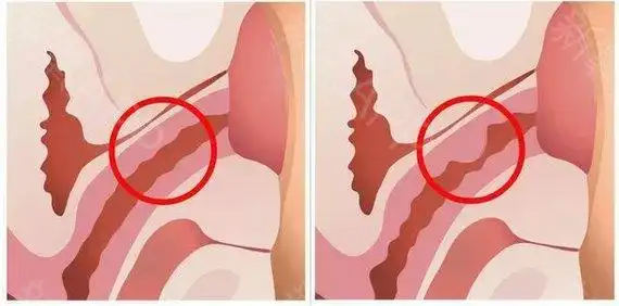 我们都知道女人的敏感部位是g点,其实不止,女人私密处的敏感点除了g点