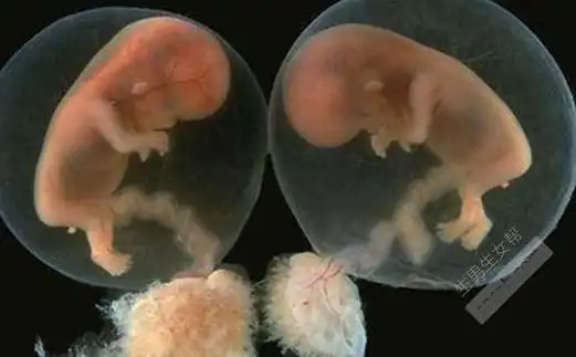 【葡萄胎早期症状】葡萄胎有什么症状_葡萄胎早期表现 - 生男生女帮