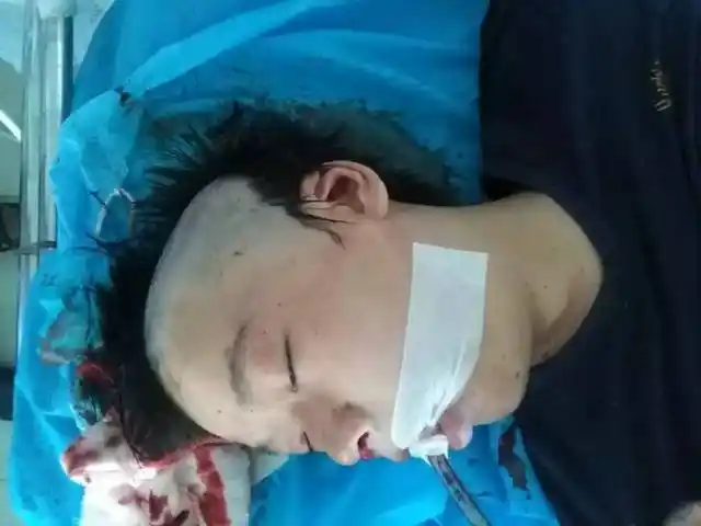 昨天中午,他不幸遭遇车祸生命垂危……家人至今没有出现,快帮他一起