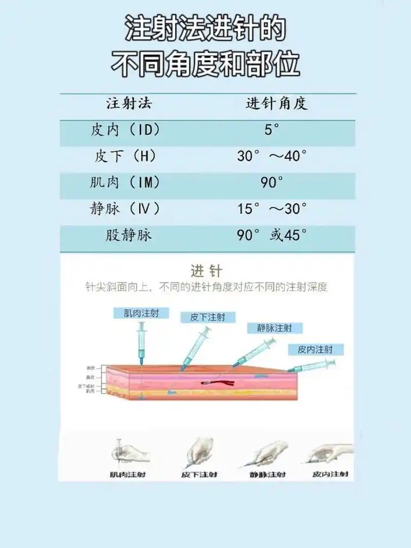 注射法进针的不同角度和部位