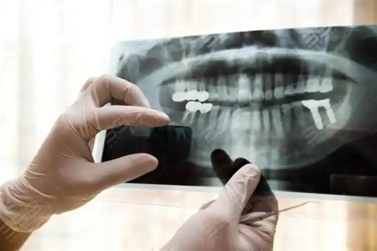 拍牙片和拍ct对身体有危害吗?