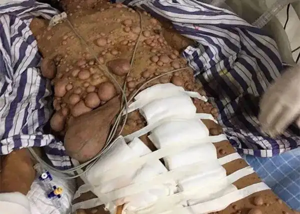 【健康课堂】胆小勿入!看这种病堪比看恐怖片