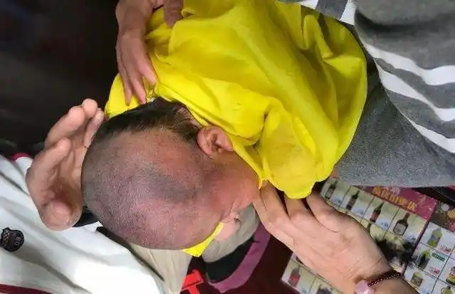 宝宝满月剃光头以后头发长得又黑又密又漂亮这样可能弊大于利