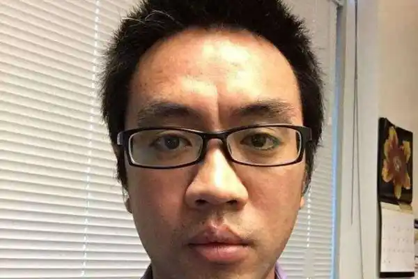 正常情况下,人体的印堂气色比周围略白,一旦印堂颜色异常,呈黑色或