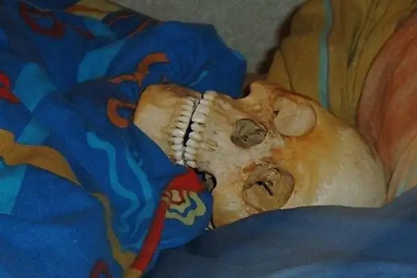 瑞典女子因与骷髅发生性关系遭指控组图