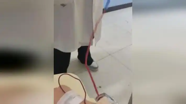 女子输液没注意看,输液管回血,医生淡定卷管排气