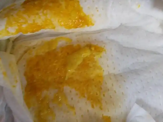 建议带孩子到医院先化验大便常规检查 向敏   2016-06-06 16:49  宝宝