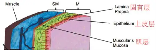 早癌诊断基础食管黏膜层微血管结构表现