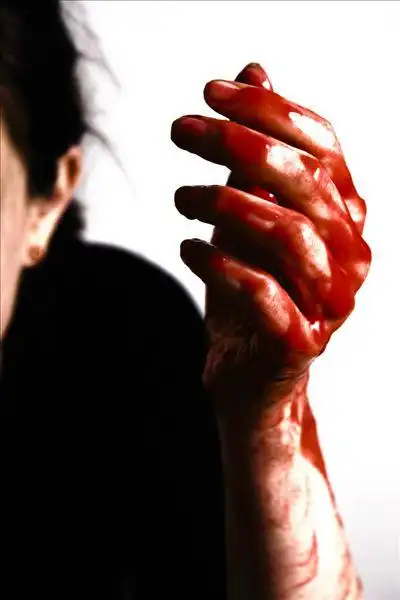 伤口图片_伤口图片大全_全景网