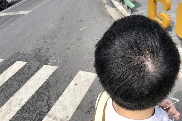 头上三个旋的男孩好吗 头上三个旋的男孩好不好 - 木鱼号