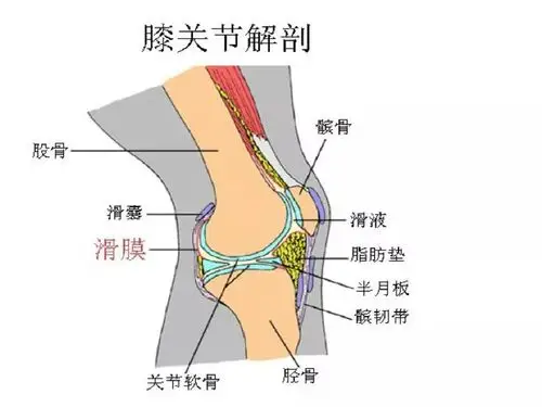 膝关节创伤性滑膜炎