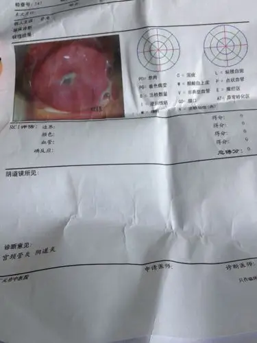 夏恩兰 主任医师 怀孕6周做了检查才知道自己怀孕,还有宫颈糜烂重度