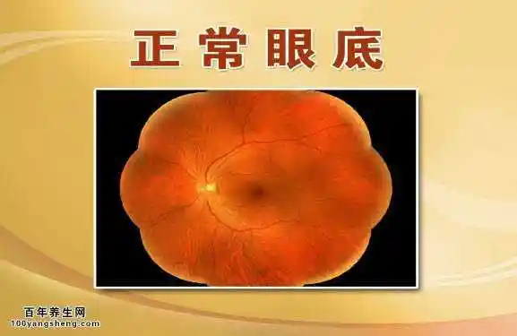 正常眼底