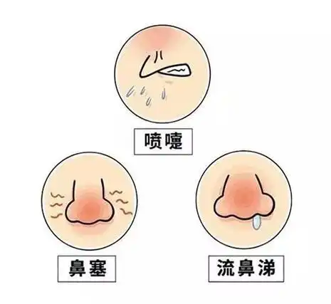 小南话科普得了慢性鼻炎鼻涕连连我该怎么办