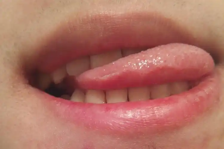 舌头上扁平疣