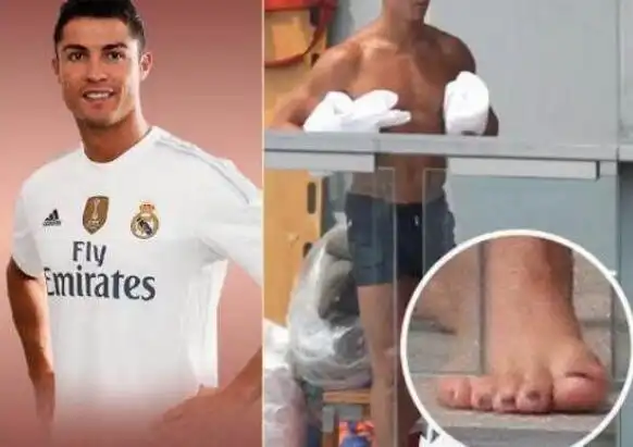 科比的手指,c罗的脚,泰森的脖子,你就懂成功有多不易