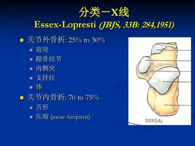 无忧文档 所有分类 医药卫生 跟骨骨折诊治ppt 分类