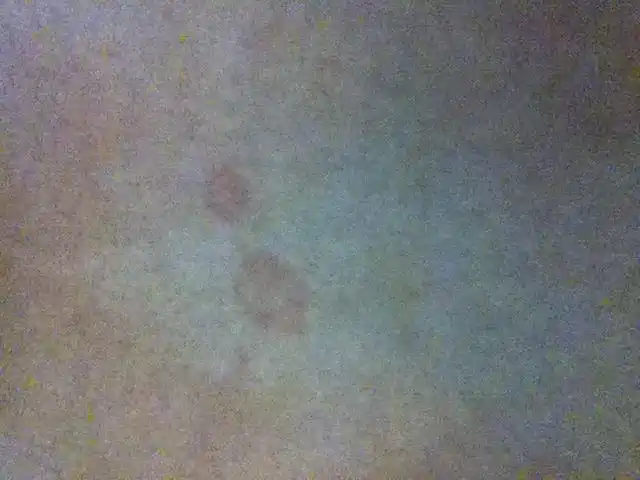 皮肤上出了红斑,不痛不痒,抓一下起糠皮