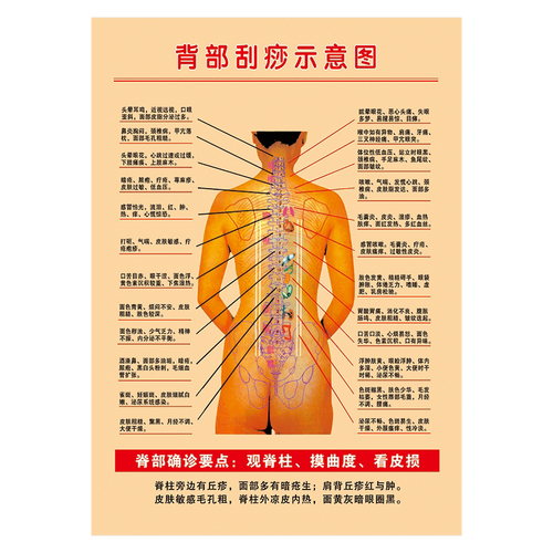人体穴位挂图中医宣传画海报经络穴位背部刮痧示意图墙贴纸wsa wsa20