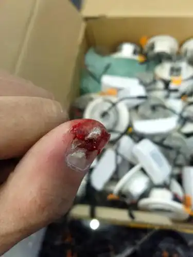 我指甲破了怎么办