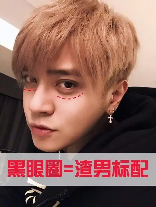 罗志祥的黑眼圈到底是不是乱导致的