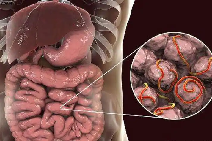 小孩肚子有蛔虫是什么样子的症状