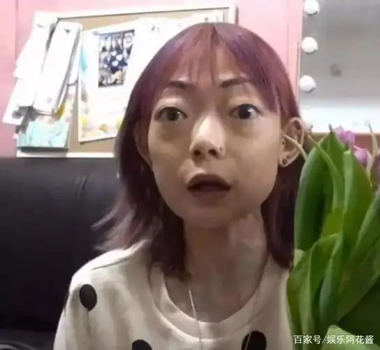 知名女模放弃牛津嫁豪门,婚后瘦成44斤"怪物",丈夫另娶他人