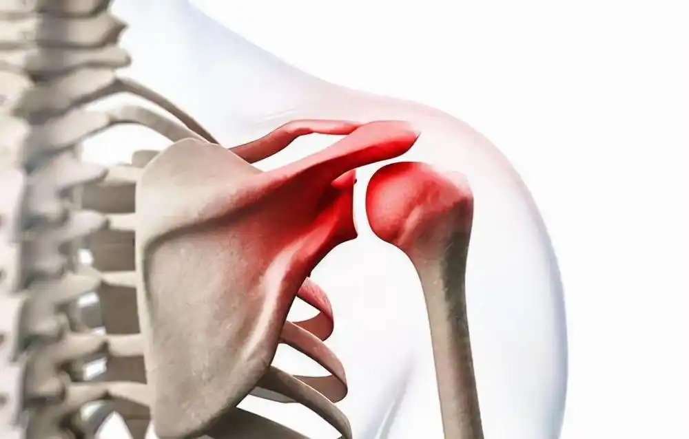 肩峰下滑囊炎虽然没有生命威胁,患者的疼痛感强烈,严重时可切除