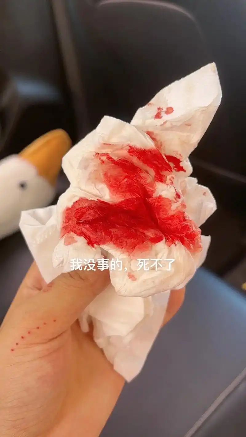 今天吐了半斤血,用了两包纸,也没去医院 - 抖音